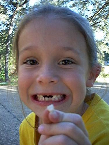 katestooth