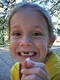 katestooth